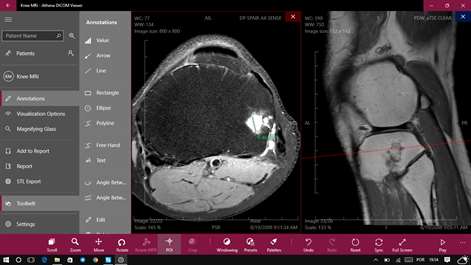 free download dicom image viewer for mac